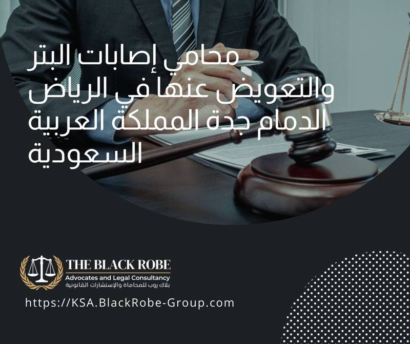 محامي إصابات البتر والتعويض عنها في الرياض الدمام جدة المملكة العربية السعودية
